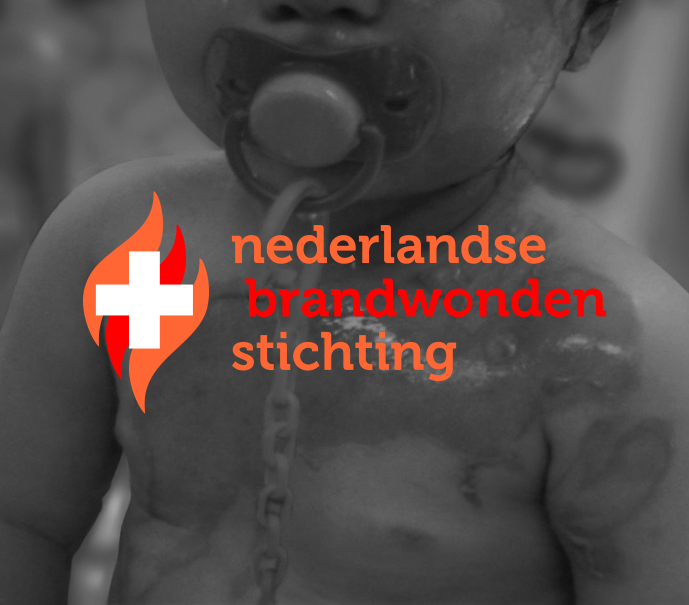 Espaz, sponsor van de Nederlandse Brandwonden Stichting.